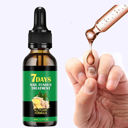Natural Herbal Nail Fungus Treatment Serum Tincture: For nail fungus infections, cracked, rough, discolored nails, brittle and split toenails and fingernails. 7 Day Repair!